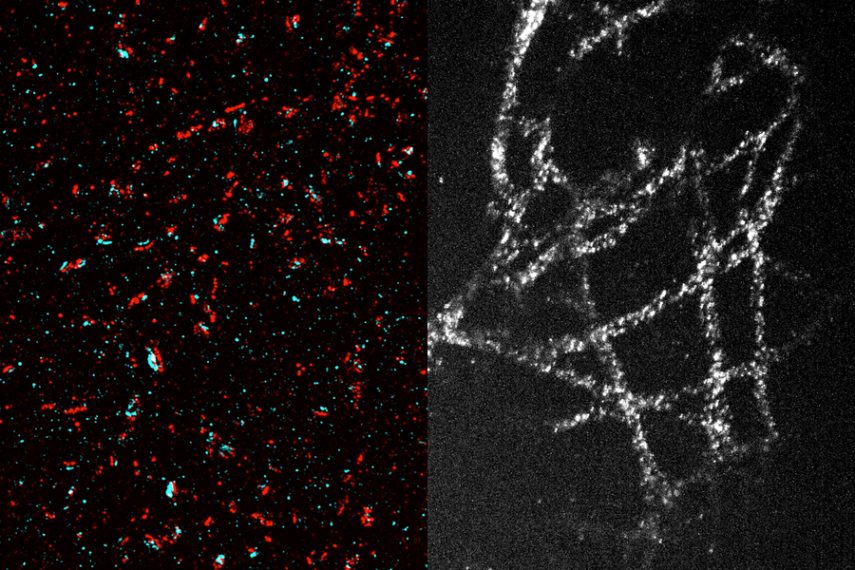 High-resolution images of synapses and microtubules