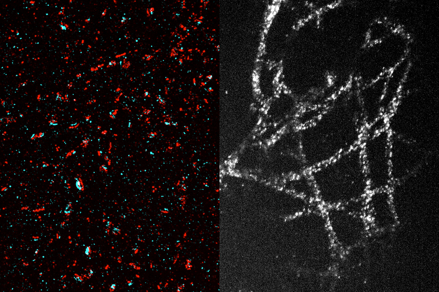 High-resolution images of synapses and microtubules